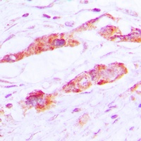 CLIC4 Antibody [KO/KD Validated]