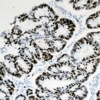 Anti-HBP1 Antibody