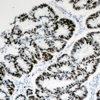 HBP1 antibody