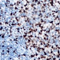 Anti-ANKRD1 Antibody