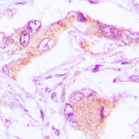 Anti-MRPL13 Antibody