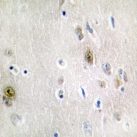 Anti-TRA2A Antibody