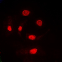 Anti-TRA2A Antibody