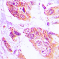Anti-NGEP Antibody