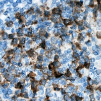 CDKL3 antibody