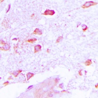 Anti-NSG2 Antibody