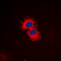 Anti-ZAK Antibody