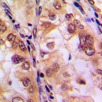 Anti-Histone Deacetylase 8 (Phospho-S39) Antibody