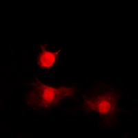 Anti-Histone Deacetylase 8 (Phospho-S39) Antibody