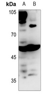 BAIAP2L1 Antibody