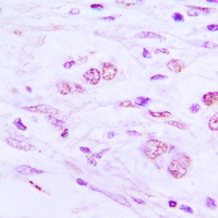 Anti-BAIAP2L1 Antibody