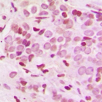 Anti-BAF250B Antibody