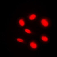 Anti-BAF250B Antibody