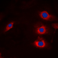 Anti-HECW2 Antibody