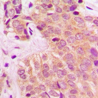 Anti-MARK4 Antibody