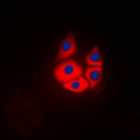 Anti-MARK4 Antibody