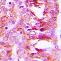 Anti-KCNK15 Antibody