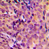 Anti-MRPL17 Antibody
