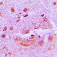 Anti-SHARP1 Antibody