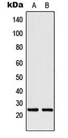 MRPL24 Rabbit Polyclonal Antibody