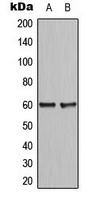 CCDC102B Antibody