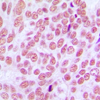 CCDC102B Antibody
