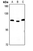CCP2 Antibody