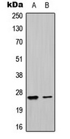 UBTD1 Antibody