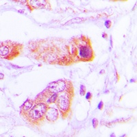 Anti-BAIAP2L2 Antibody