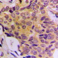 Anti-CDK5RAP3 Antibody
