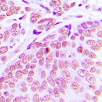 Anti-CEP70 Antibody