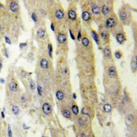 Anti-ACAD10 Antibody