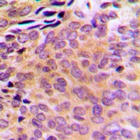 Anti-AKR1CL2 Antibody