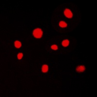 Anti-ATRIP Antibody