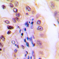 Anti-USP32 Antibody