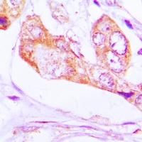 Anti-PNPT1 Antibody