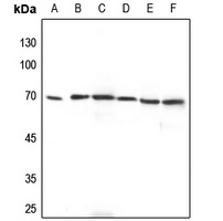 ADCK2 Antibody