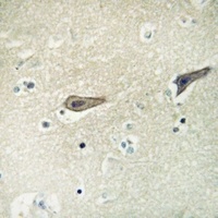 Anti-ADCK2 Antibody
