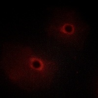 Anti-ADCK2 Antibody
