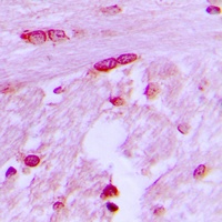 Anti-BTF3L4 Antibody