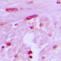 BTF3L4 antibody