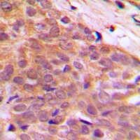 Anti-CABLES1 Antibody