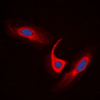 ACOT4 antibody