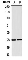 NKX2-6 Antibody