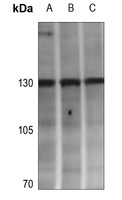 Adenylate Cyclase 4 Antibody