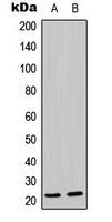 MRPL21 Antibody