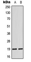 LATH Rabbit Polyclonal Antibody