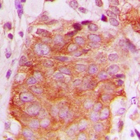 LATH Rabbit Polyclonal Antibody