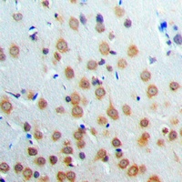 Anti-ANKRD20A3 Antibody