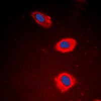 NT5C1B antibody